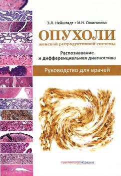 Опухоли женской репродуктивной системы: распознавание и дифференциальная диагностика
